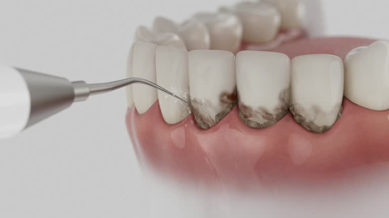Reliable Root Canal Treatment contractor in Tensas Parish County, LA by Dentist Open Now